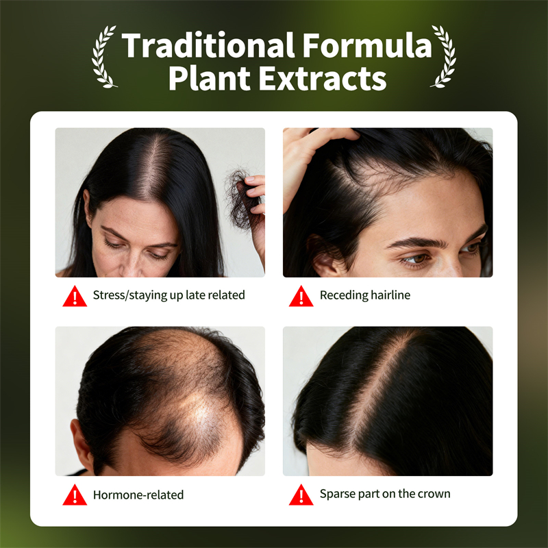 Natural Hair Growth Set Usman  - огляд і ціна Hair Care Natural Products