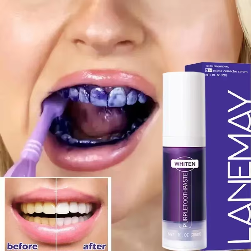 V34 Purple Teeth Whitening Too - огляд і ціна Purple Toning Shampoo