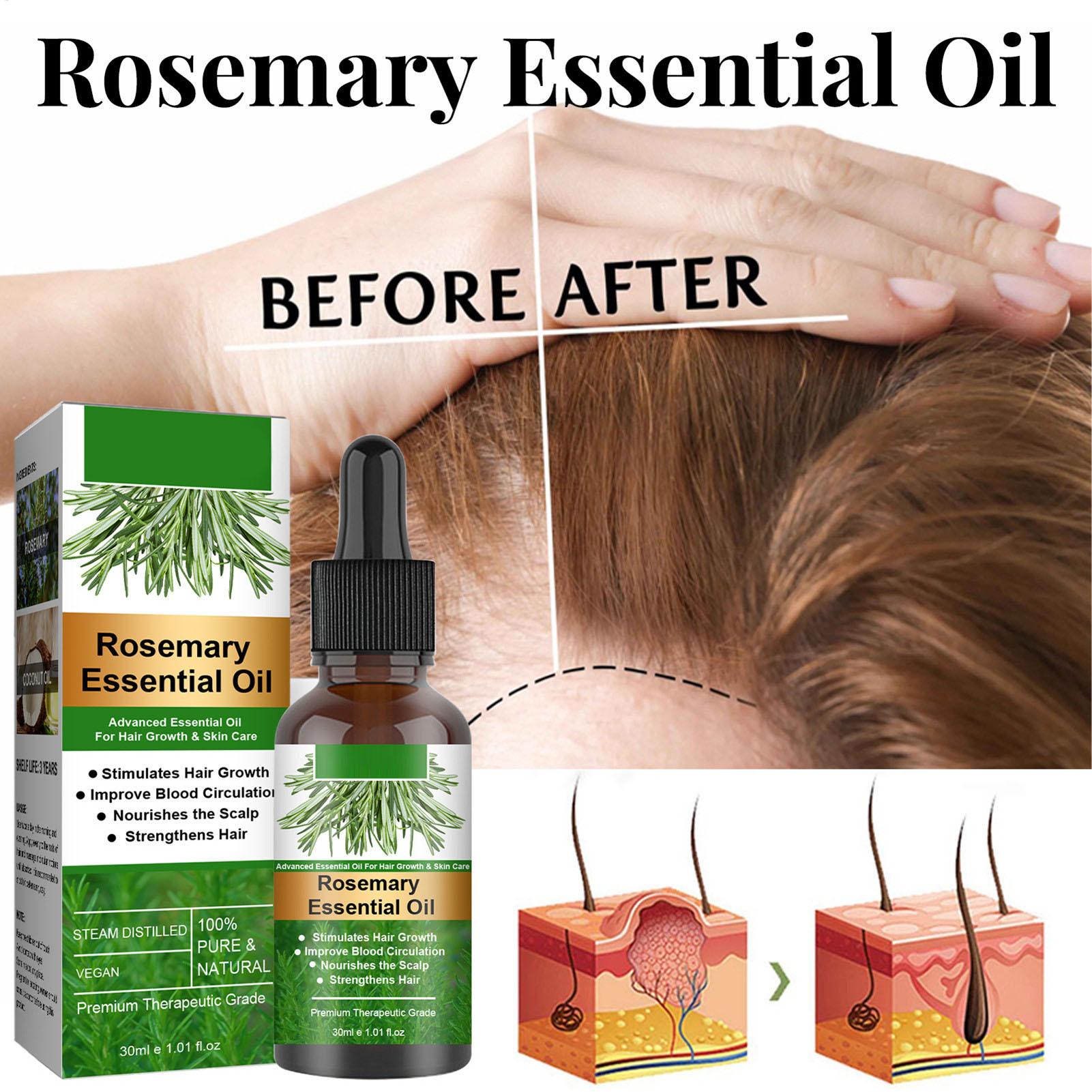 Rosemary Essential Oil Hair Gr - огляд і ціна Hair Care Natural Products