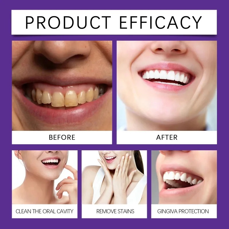 Purple Teeth Restoration Miner - огляд і ціна Purple Toning Shampoo